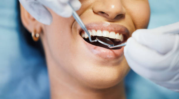 Best Emergency Cosmetic Dentistry (e.g., broken veneers) in Winlock, WA